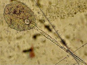 Microscopic view of the sporangium of a fungus